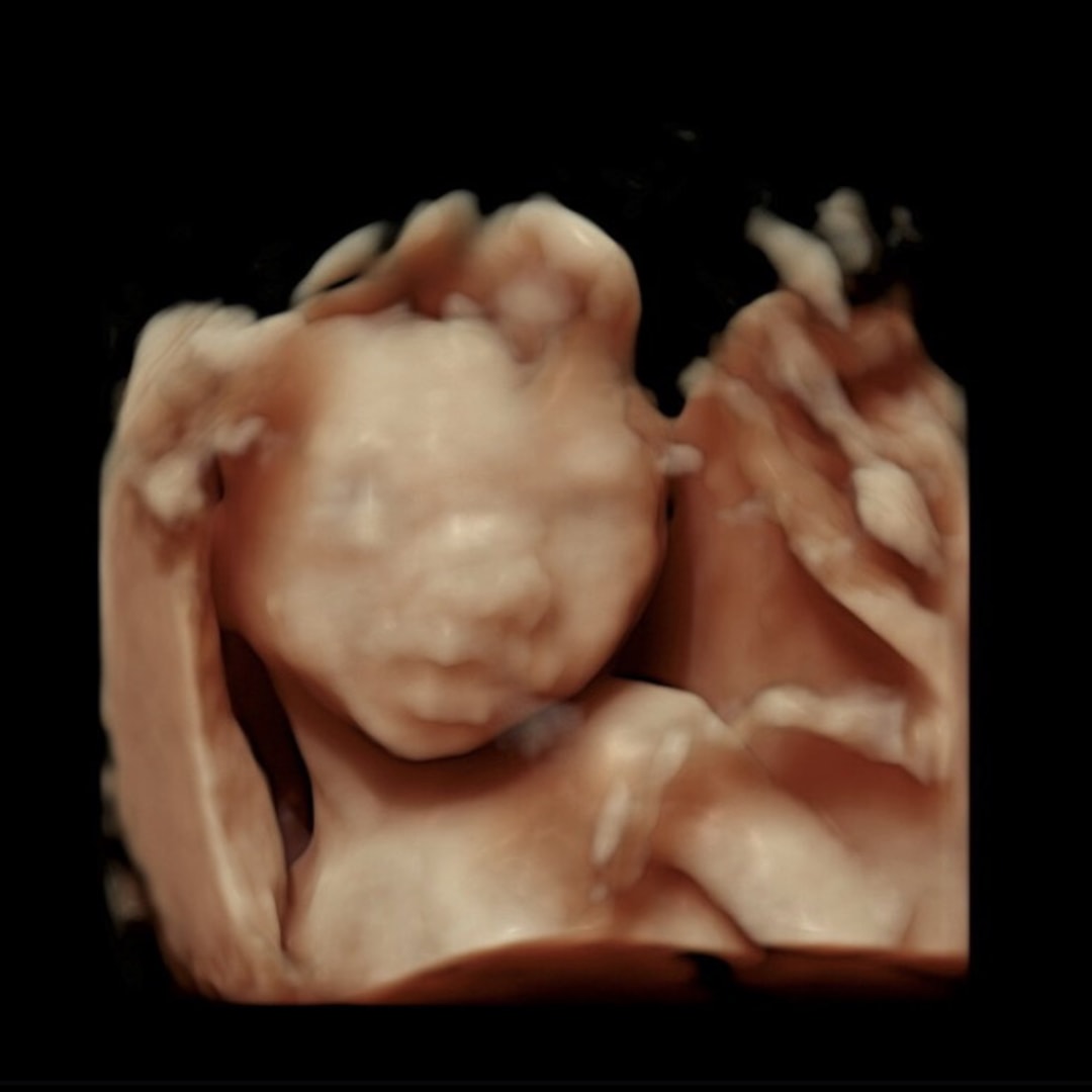 Photo shared by Mia for their Babylist baby registry.