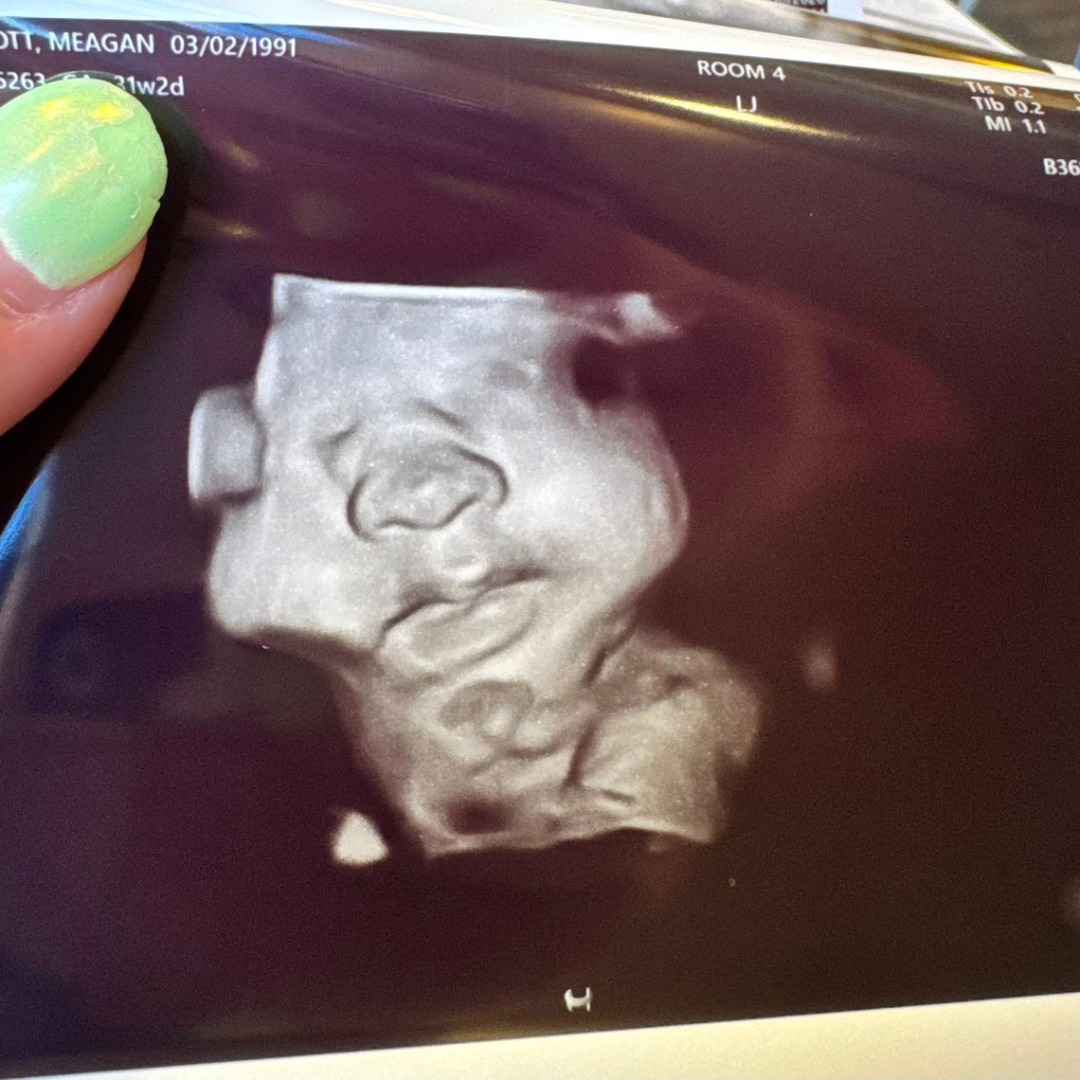 Photo shared by Meagan for their Babylist baby registry.