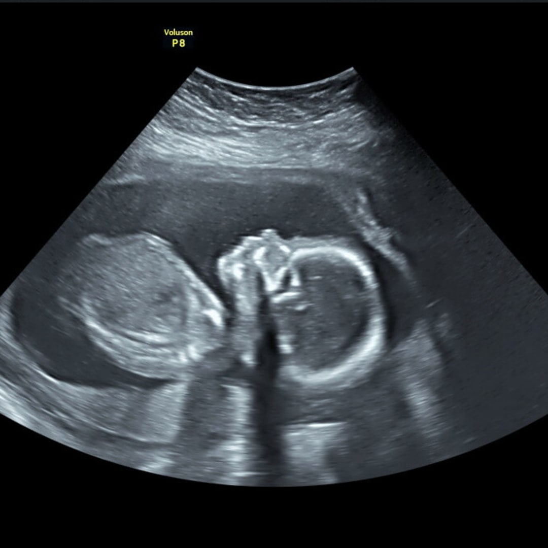 Photo shared by Carli for their Babylist baby registry.