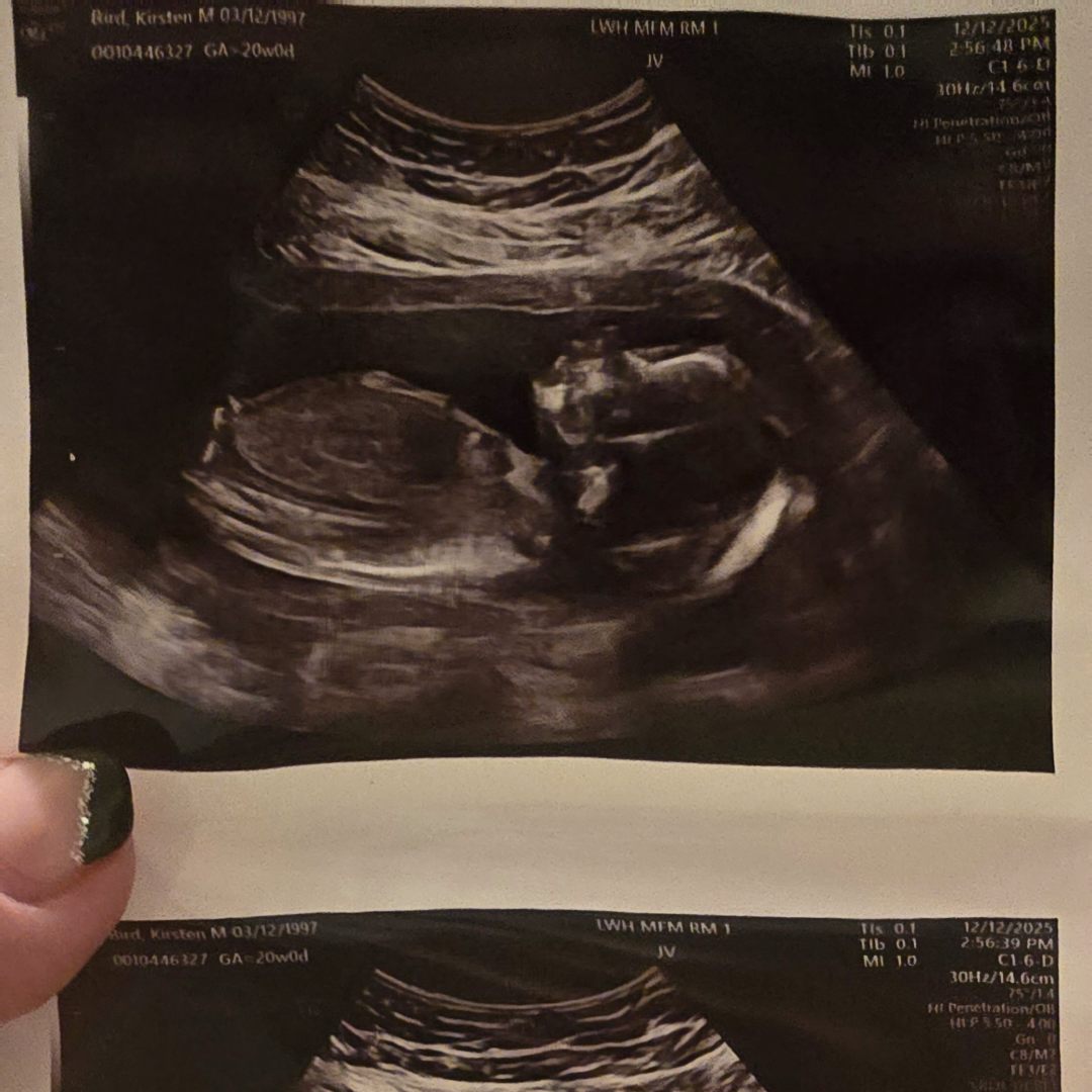 Photo shared by Kirsten for their Babylist baby registry.