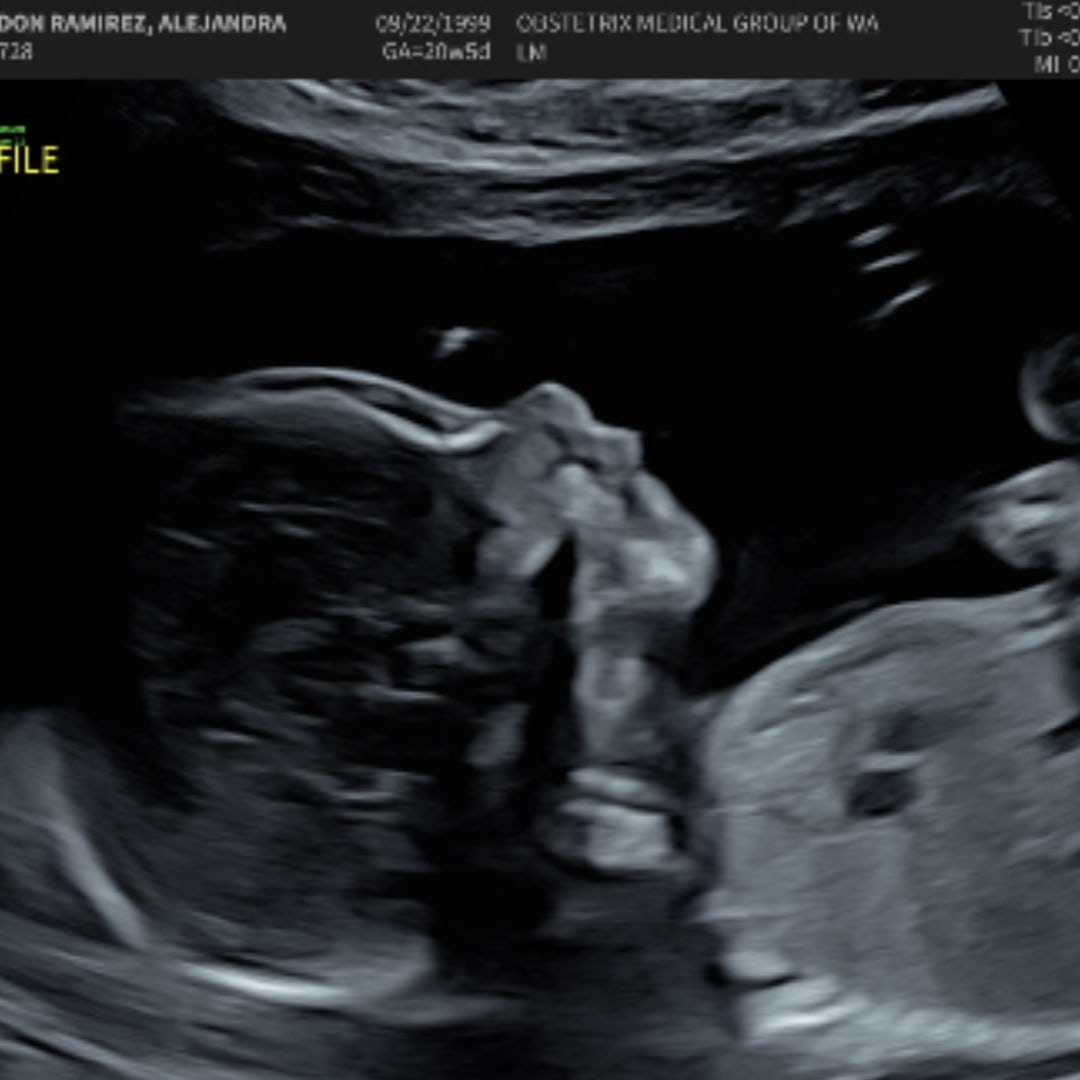 Photo shared by Alejandra for their Babylist baby registry.