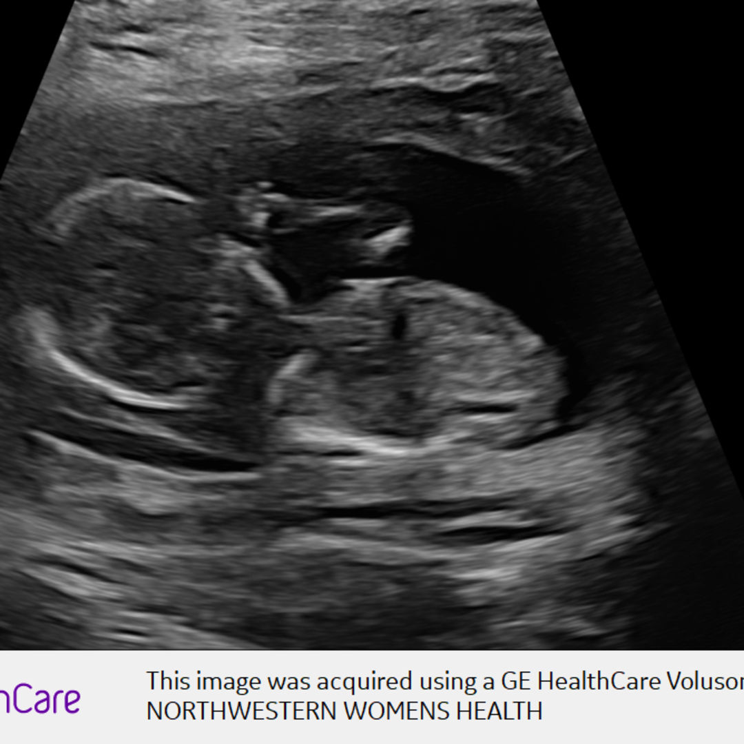 Photo shared by Samantha for their Babylist baby registry.