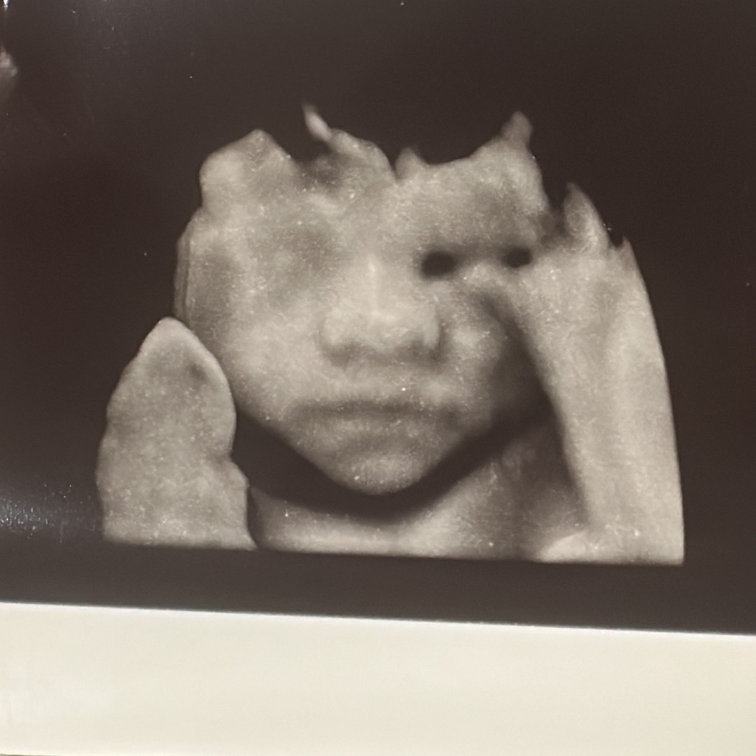 Photo shared by Chelsea for their Babylist baby registry.