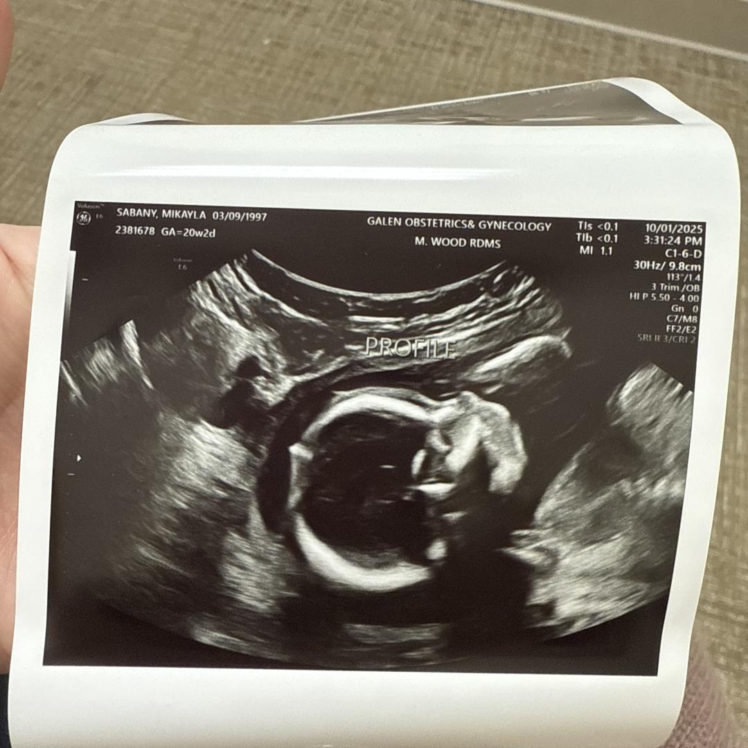 Photo shared by Mikayla for their Babylist baby registry.