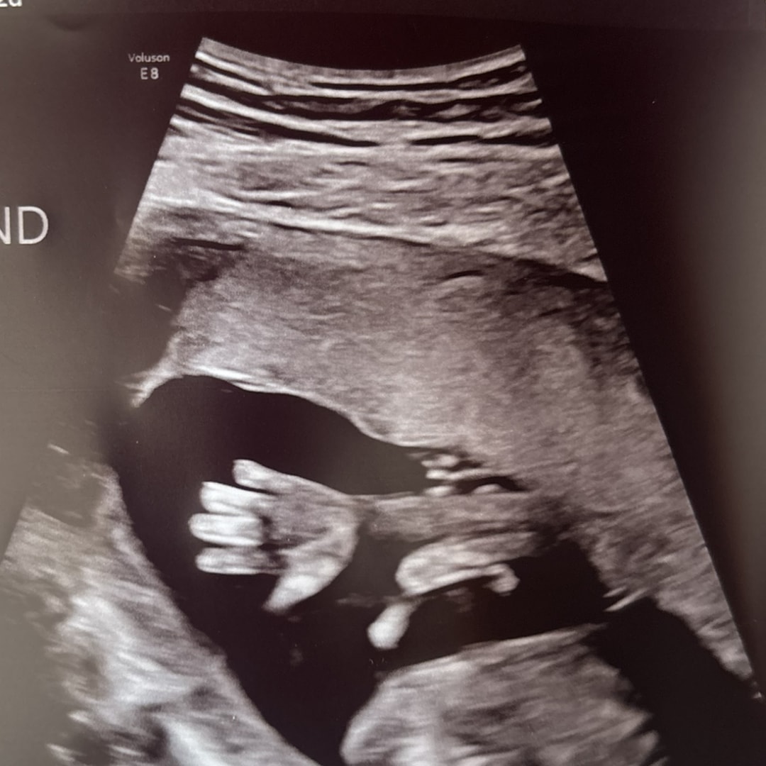Photo shared by Jazzy for their Babylist baby registry.