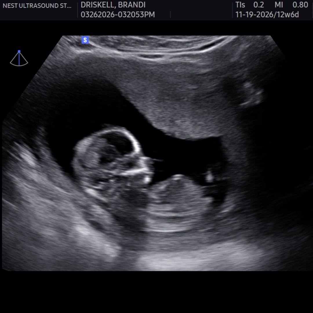 Photo shared by Brandi for their Babylist baby registry.