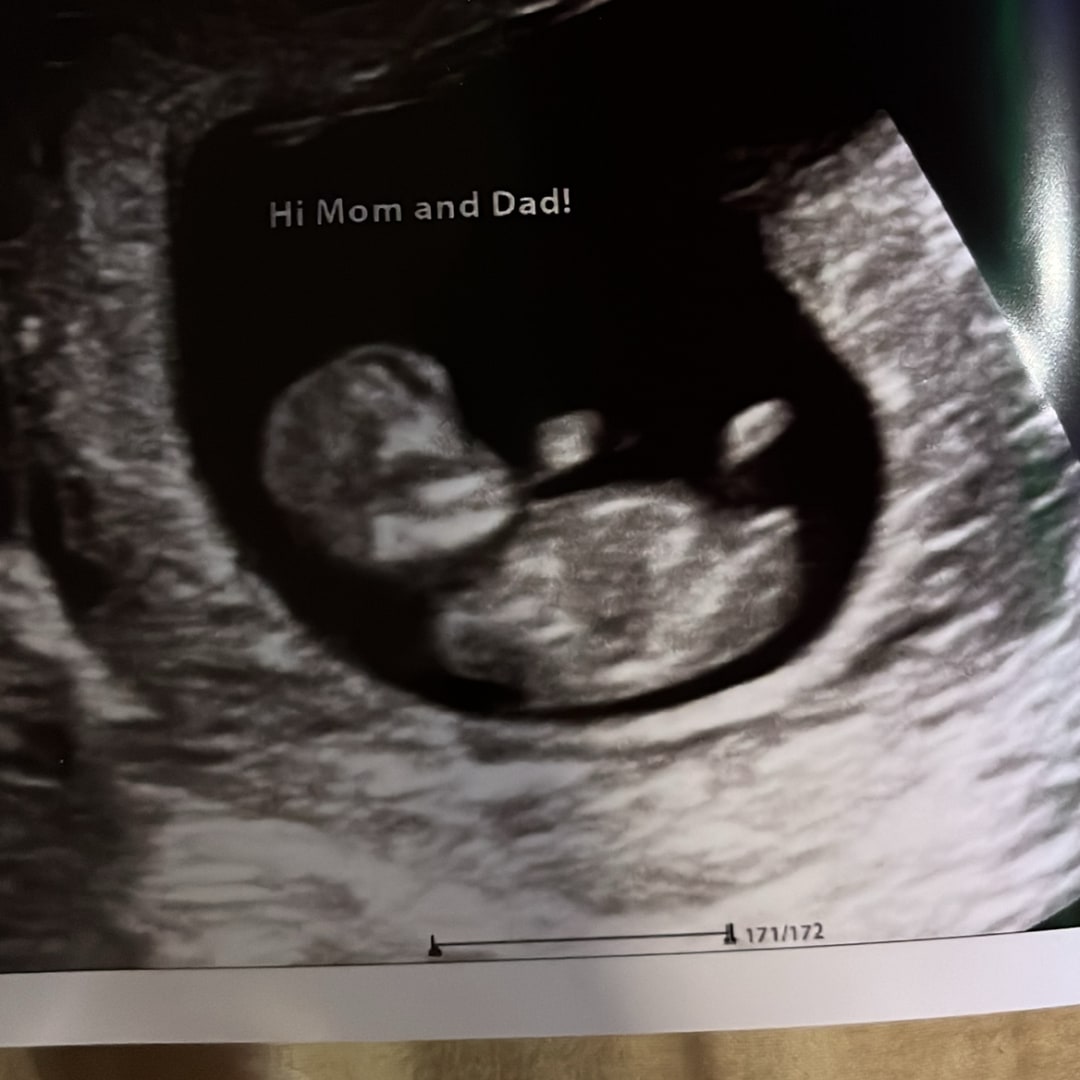 Photo shared by Jazmine for their Babylist baby registry.
