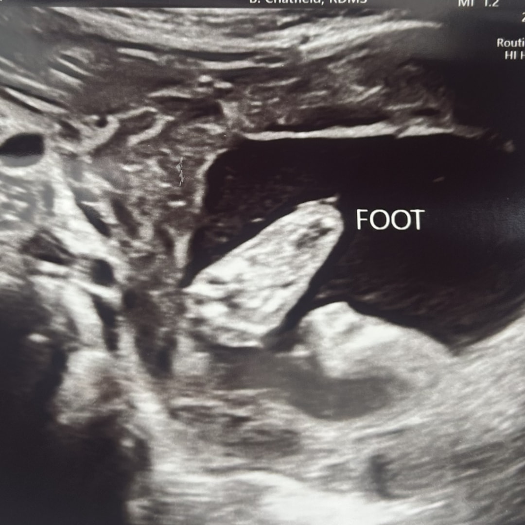 Photo shared by Caroline for their Babylist baby registry.