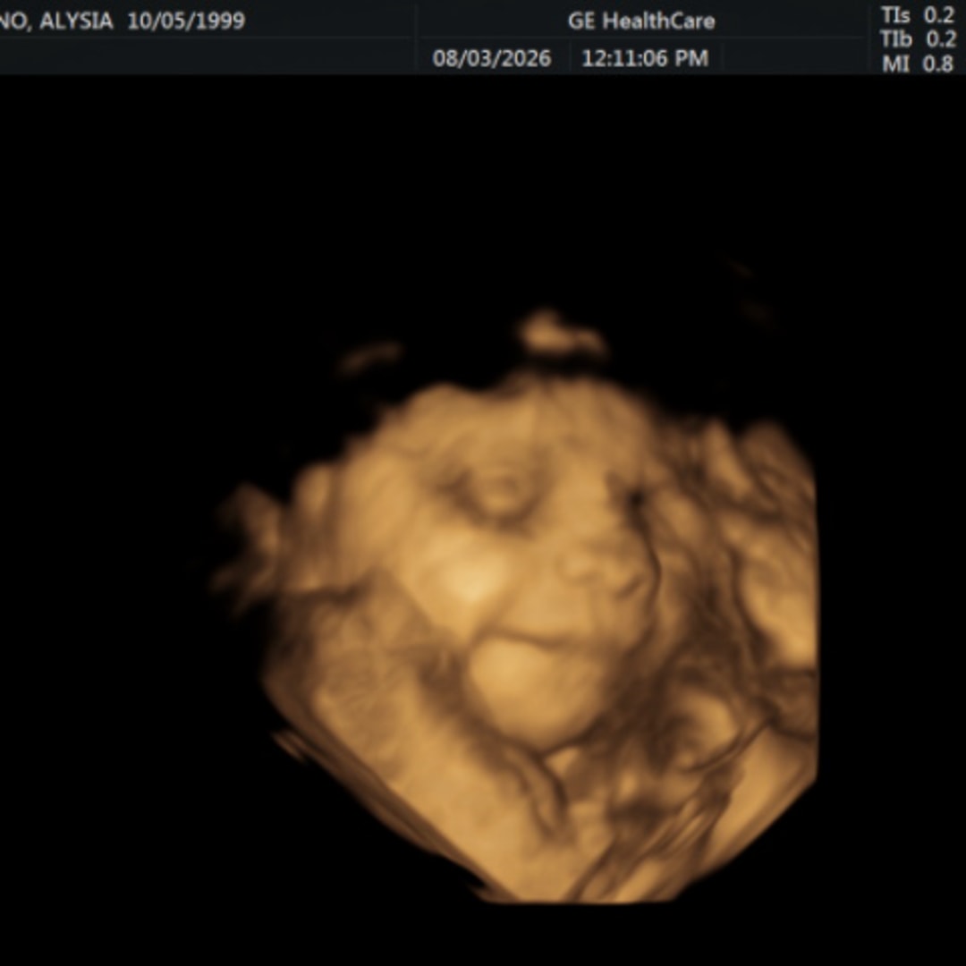 Photo shared by Alysia for their Babylist baby registry.