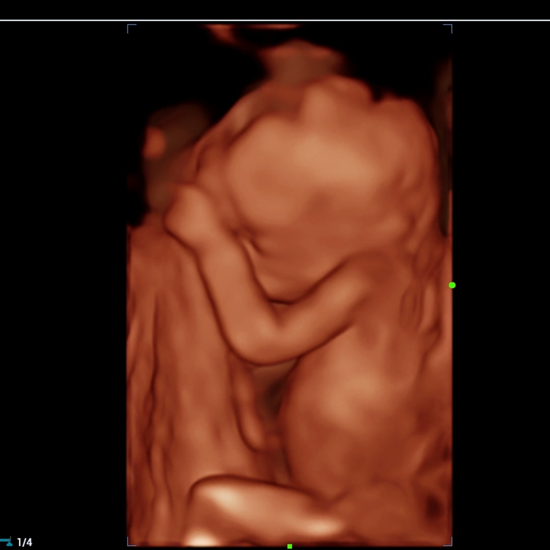 Photo shared by Shania for their Babylist baby registry.