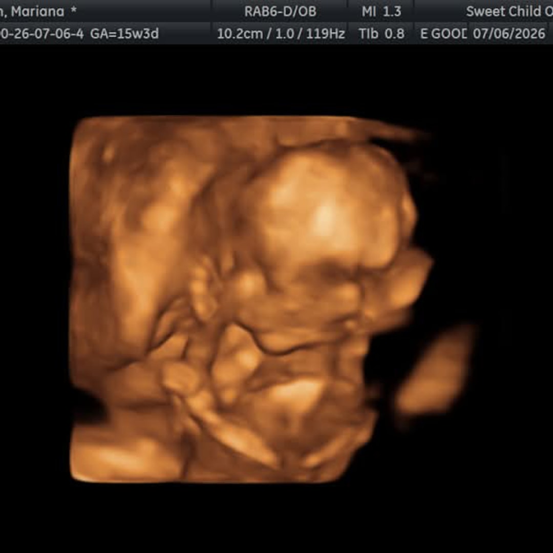 Photo shared by Mariana for their Babylist baby registry.