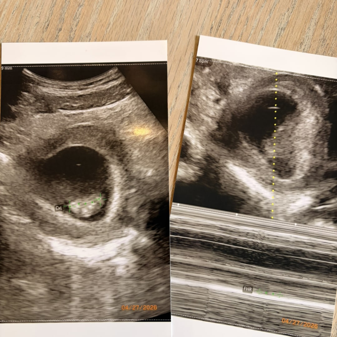 Photo shared by Emily for their Babylist baby registry.