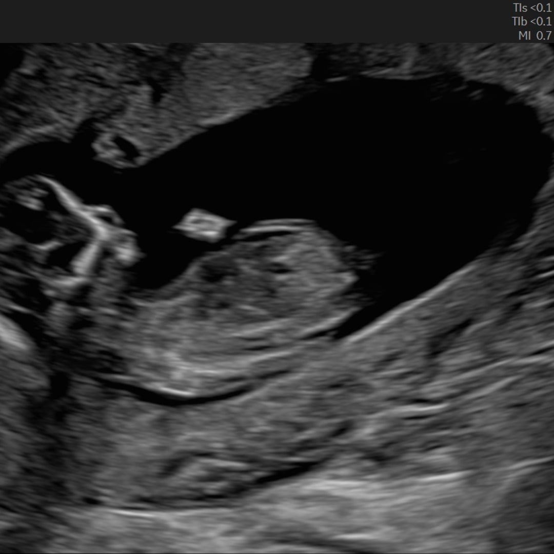 Photo shared by Ramel for their Babylist baby registry.