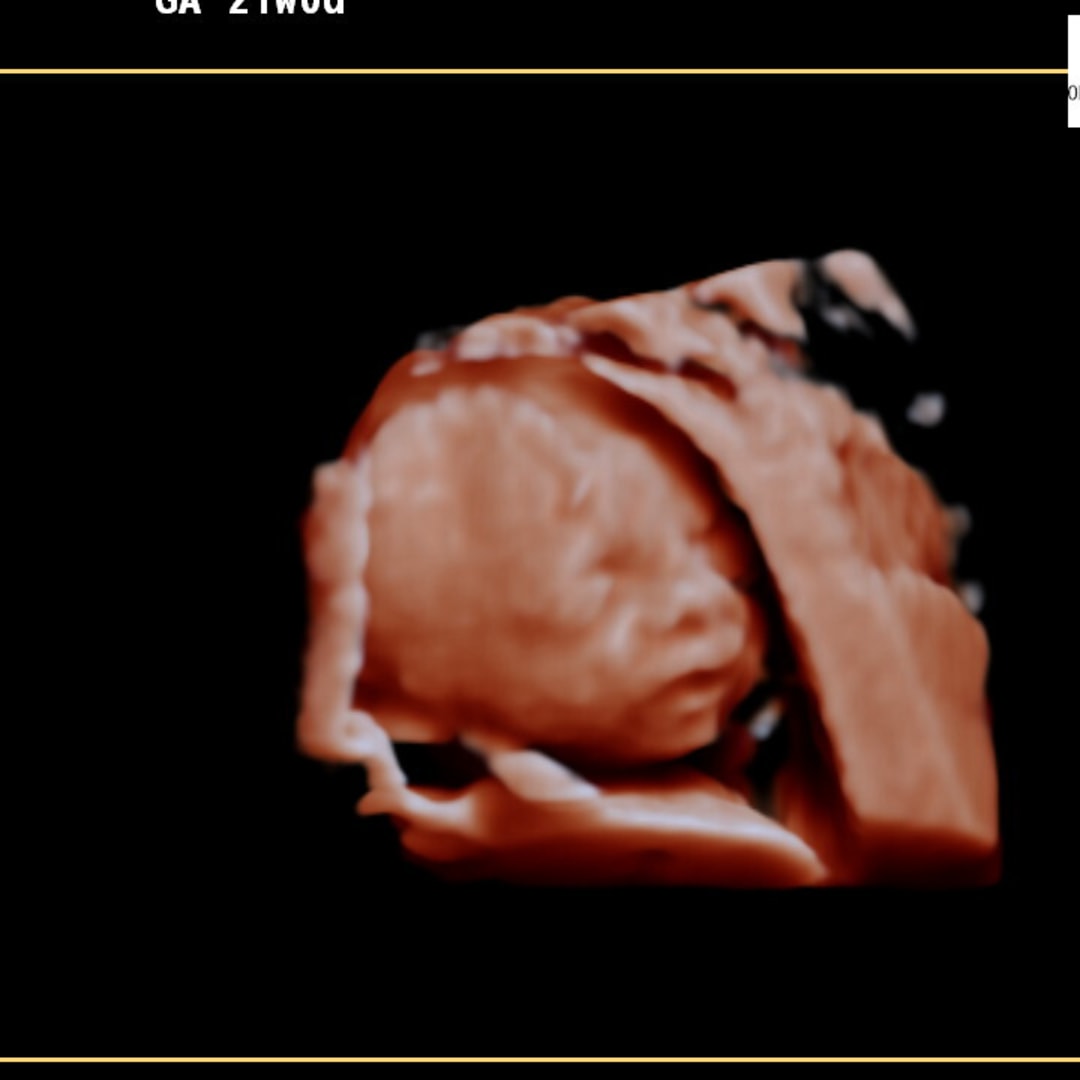 Photo shared by Janil for their Babylist baby registry.