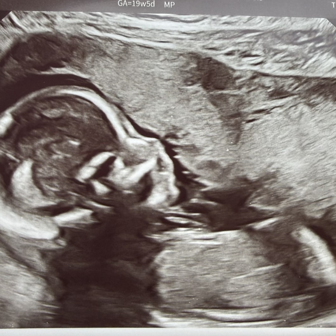 Photo shared by Christina for their Babylist baby registry.
