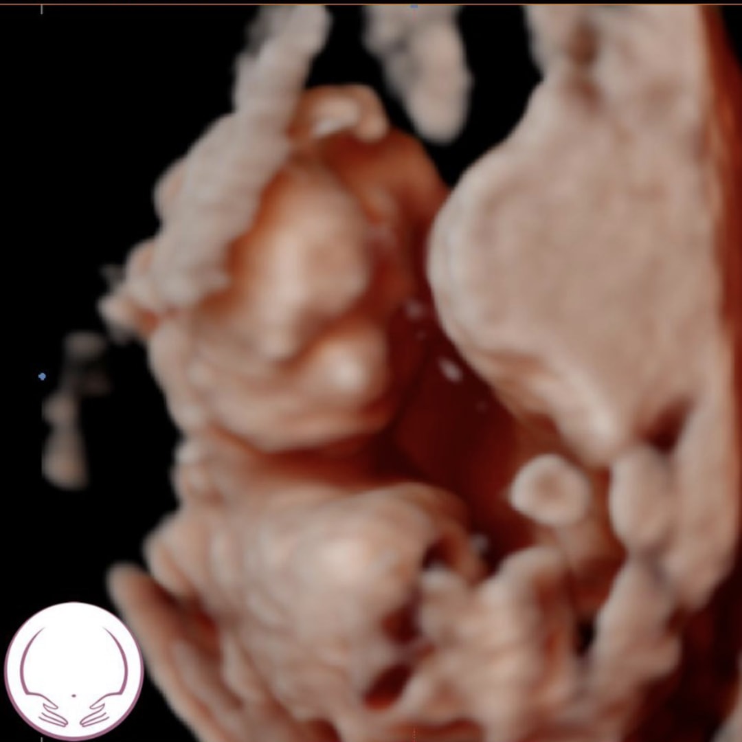 Photo shared by Ivy for their Babylist baby registry.