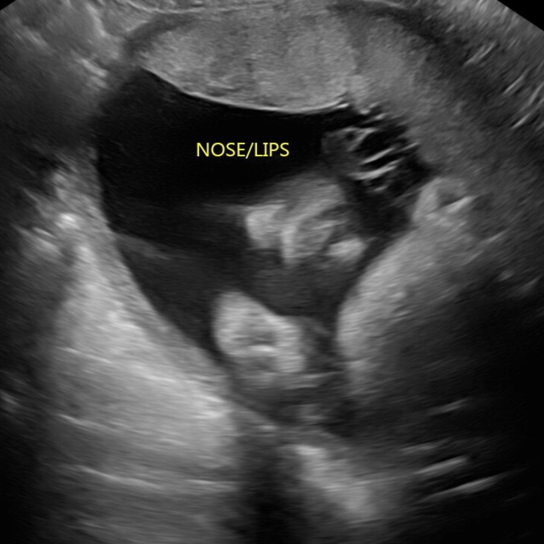 Photo shared by Lindsay for their Babylist baby registry.