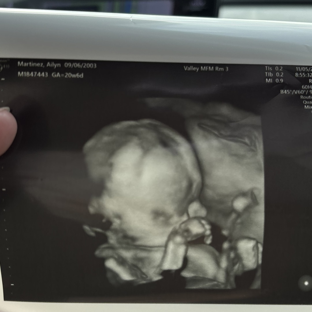 Photo shared by Ailyn for their Babylist baby registry.