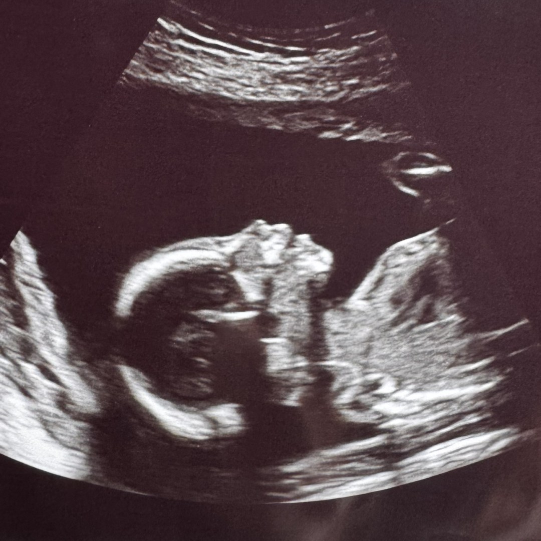 Photo shared by Meg for their Babylist baby registry.