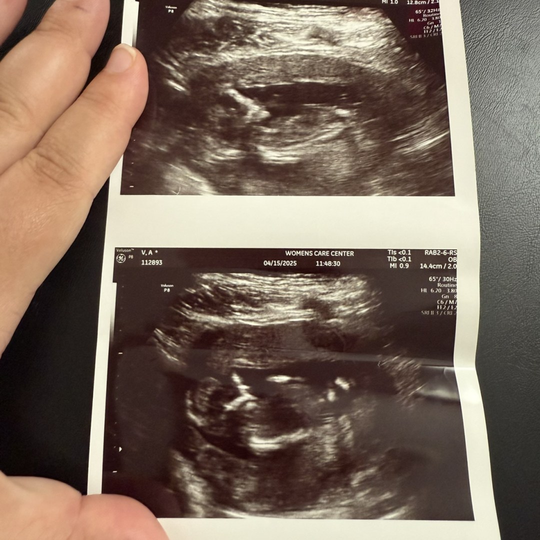 Photo shared by Alexandra for their Babylist baby registry.
