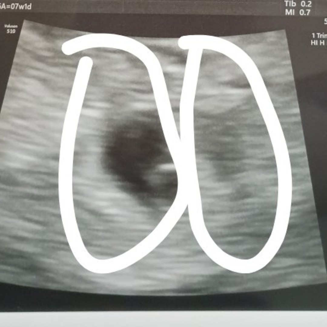 Photo shared by Kaitlyn for their Babylist baby registry.
