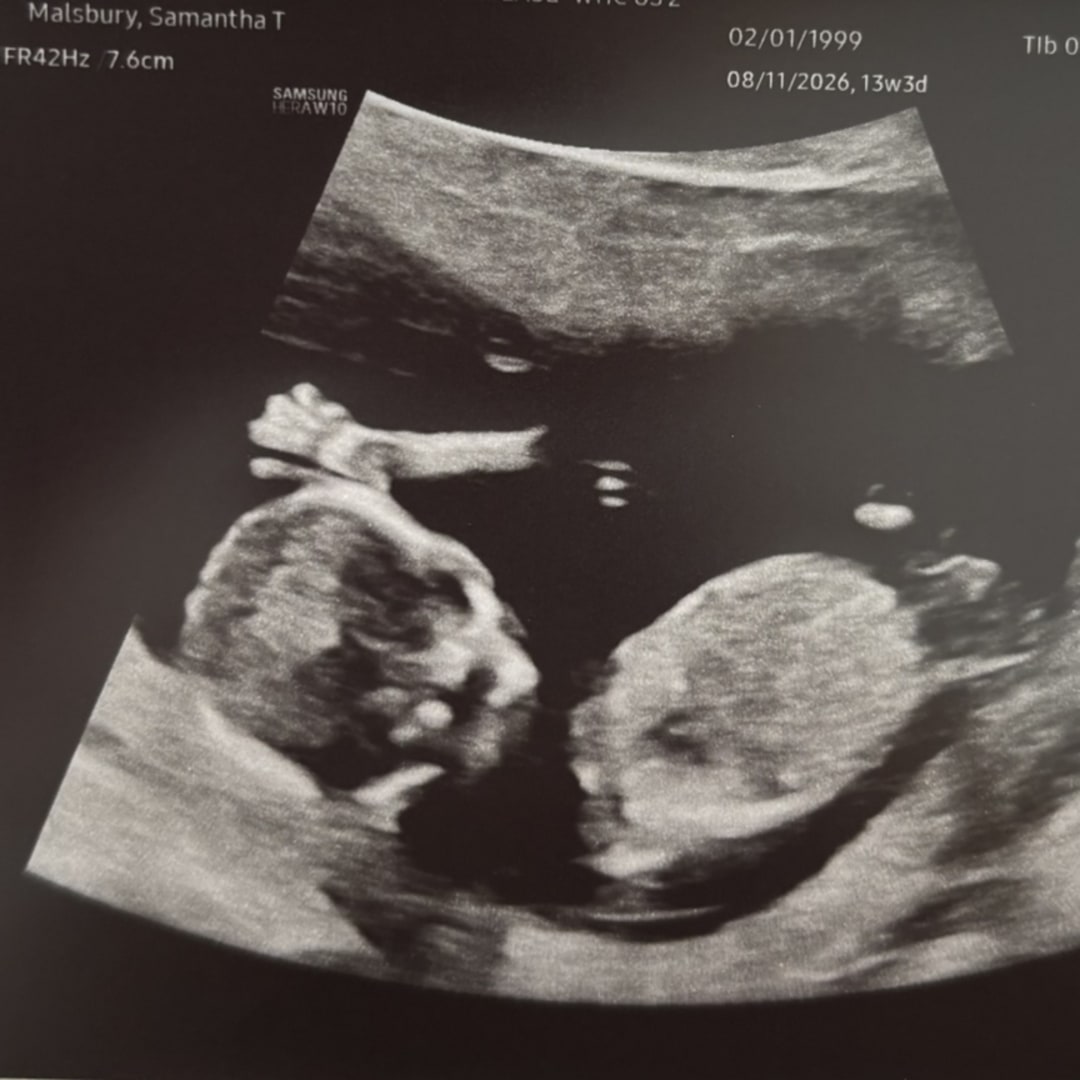 Photo shared by Samantha for their Babylist baby registry.