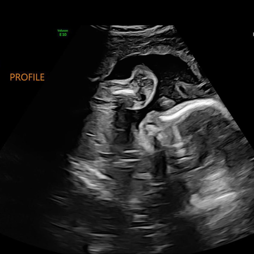 Photo shared by Arlyn for their Babylist baby registry.