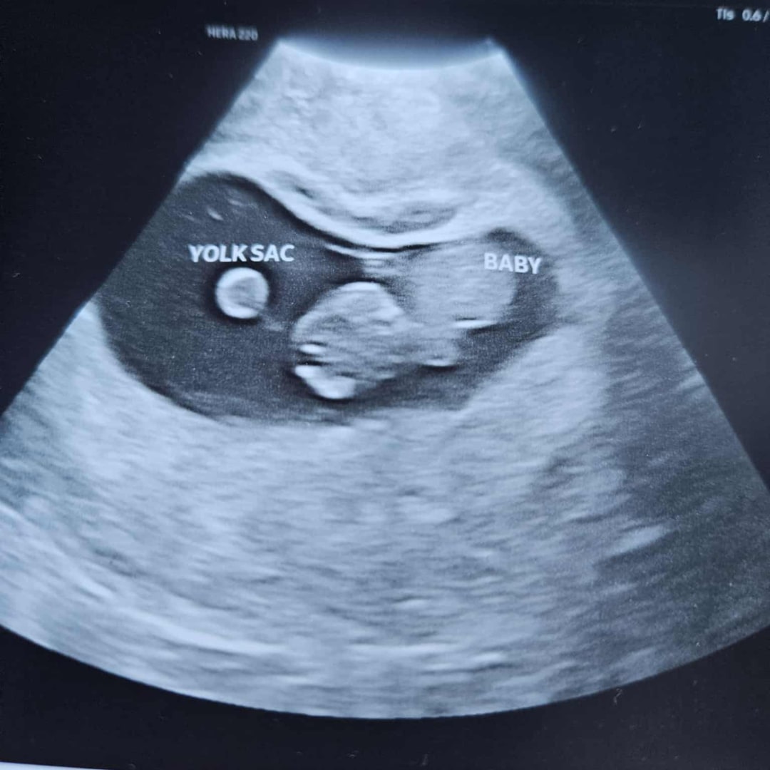 Photo shared by Emily for their Babylist baby registry.