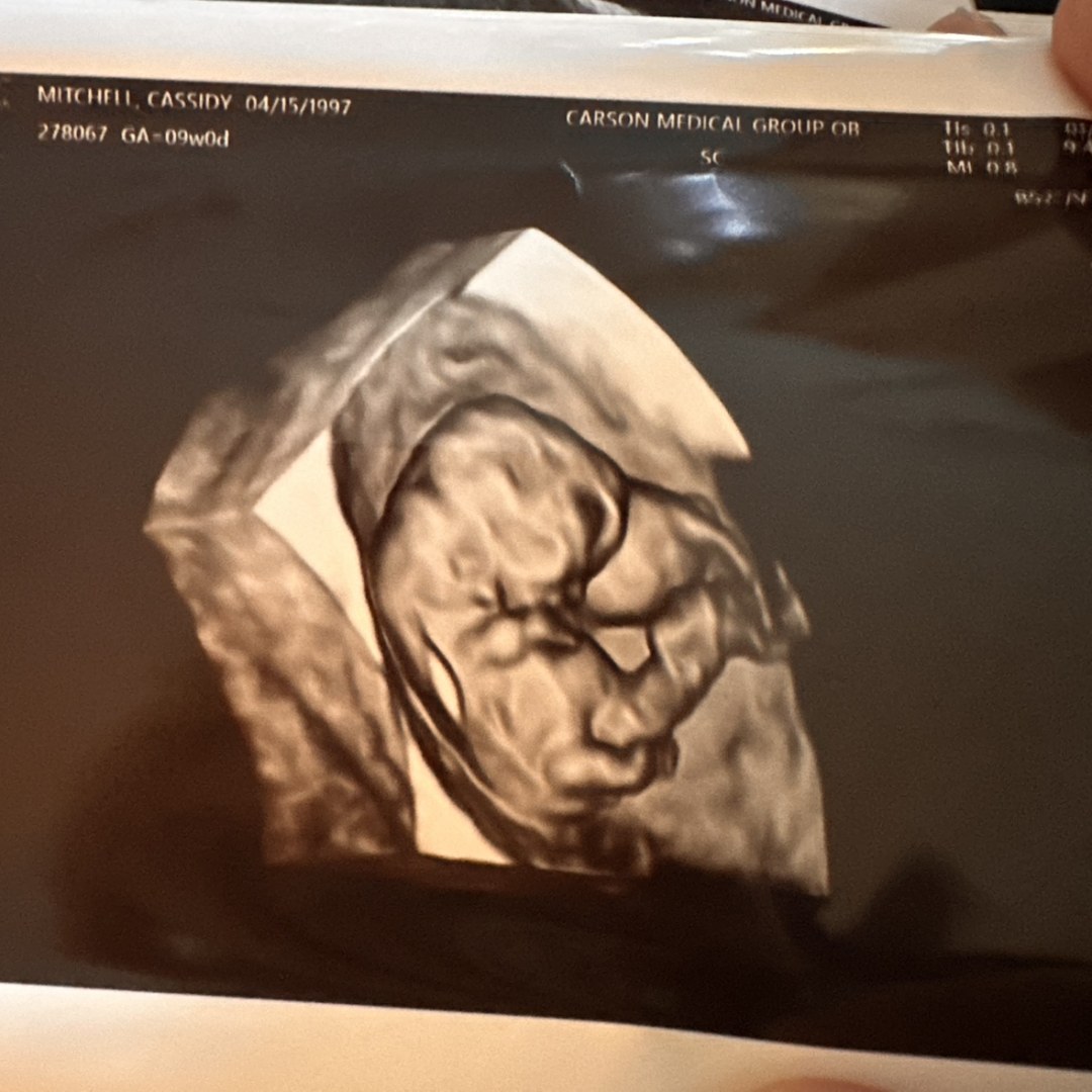 Photo shared by Cassidy for their Babylist baby registry.