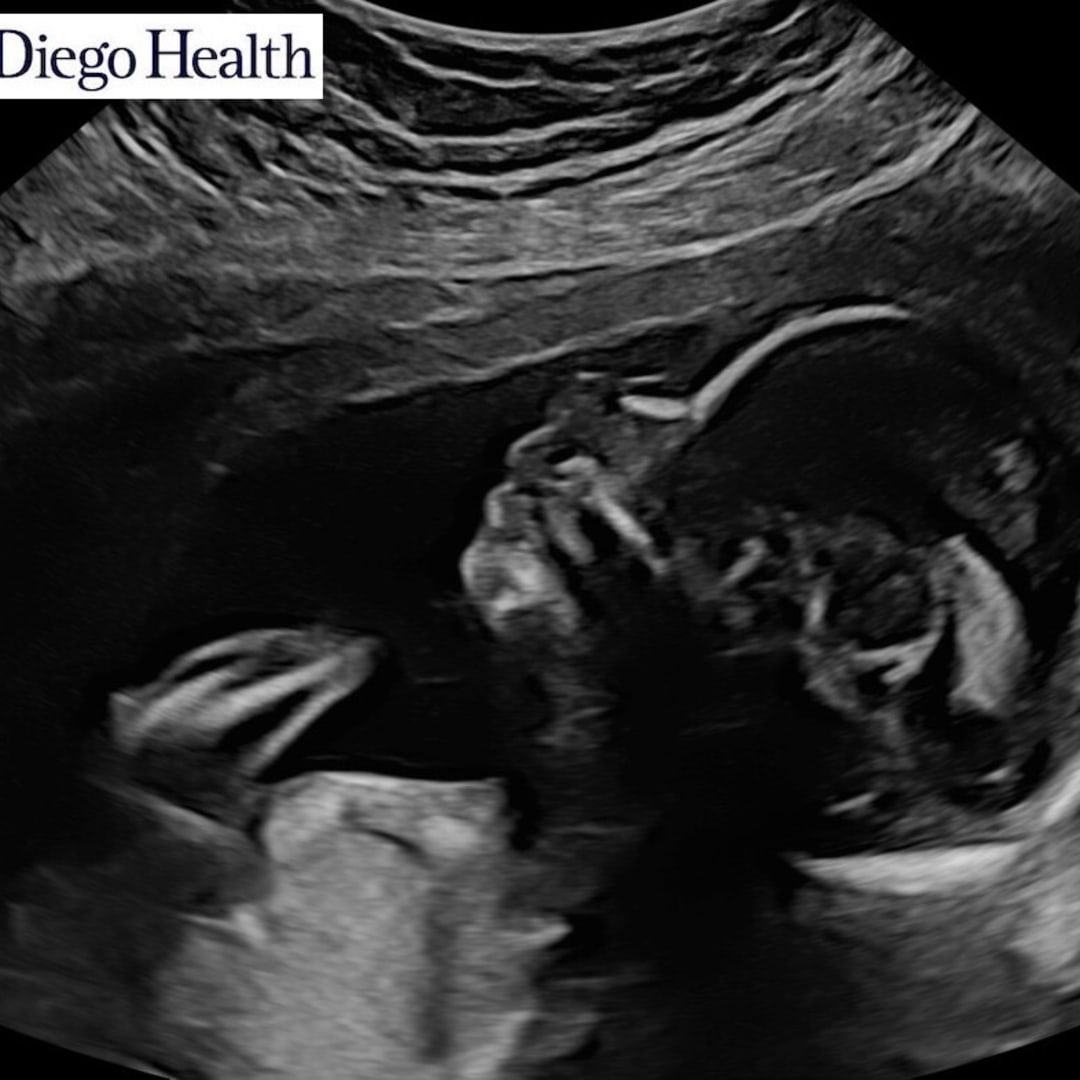 Photo shared by Van for their Babylist baby registry.
