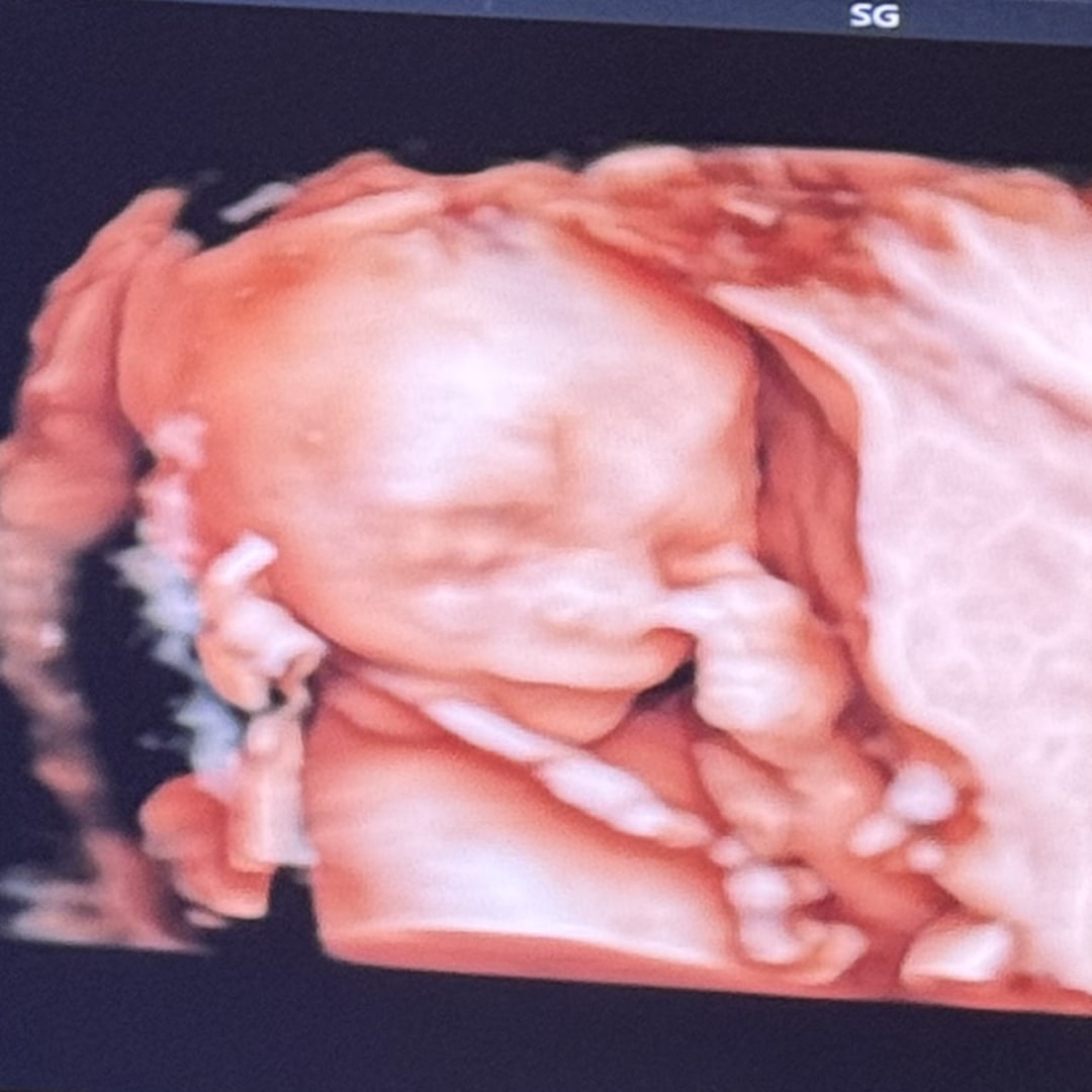 Photo shared by Desiree for their Babylist baby registry.