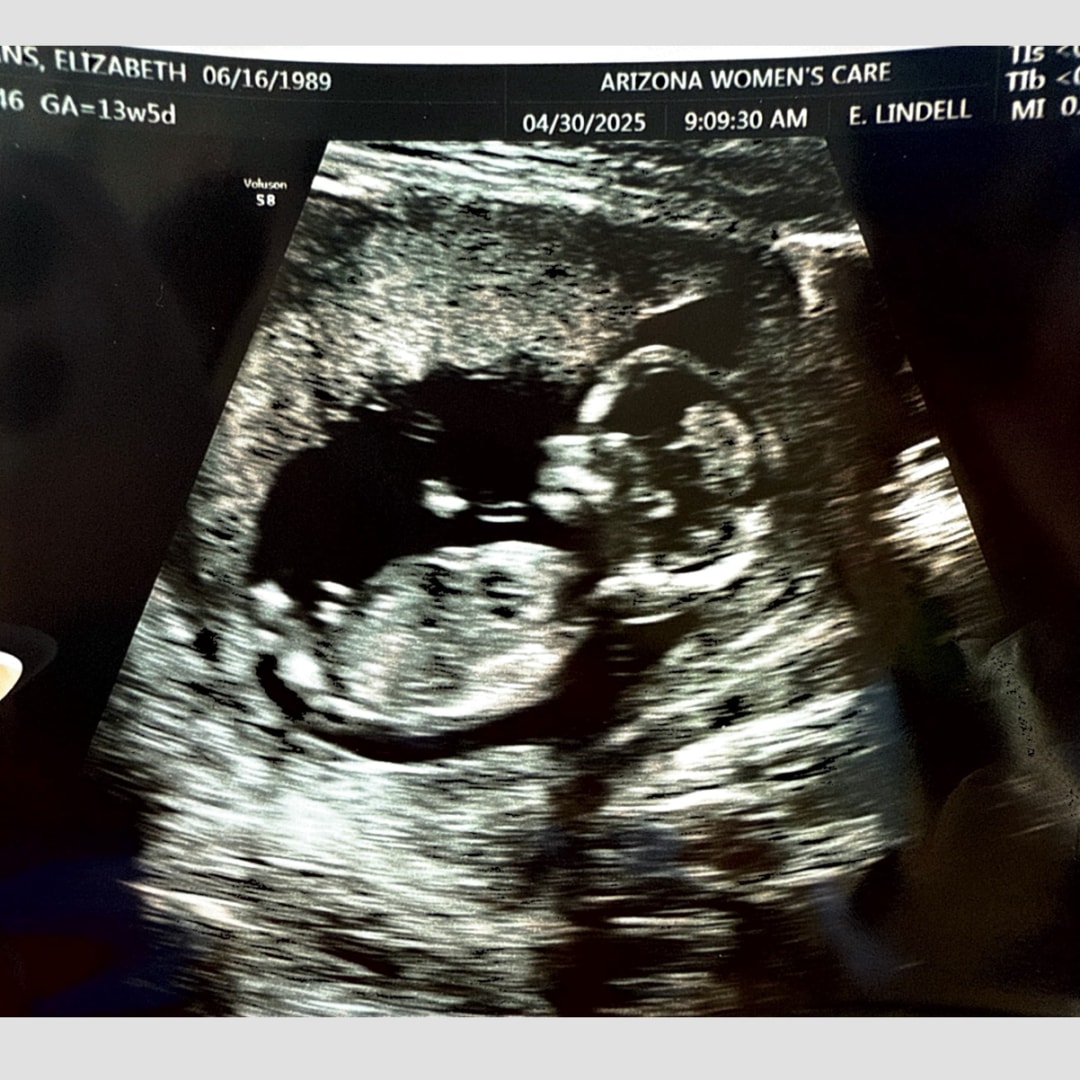 Photo shared by Elizabeth for their Babylist baby registry.