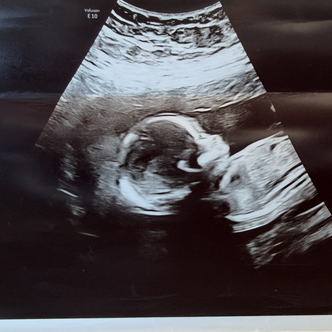 Photo shared by Sarah for their Babylist baby registry.