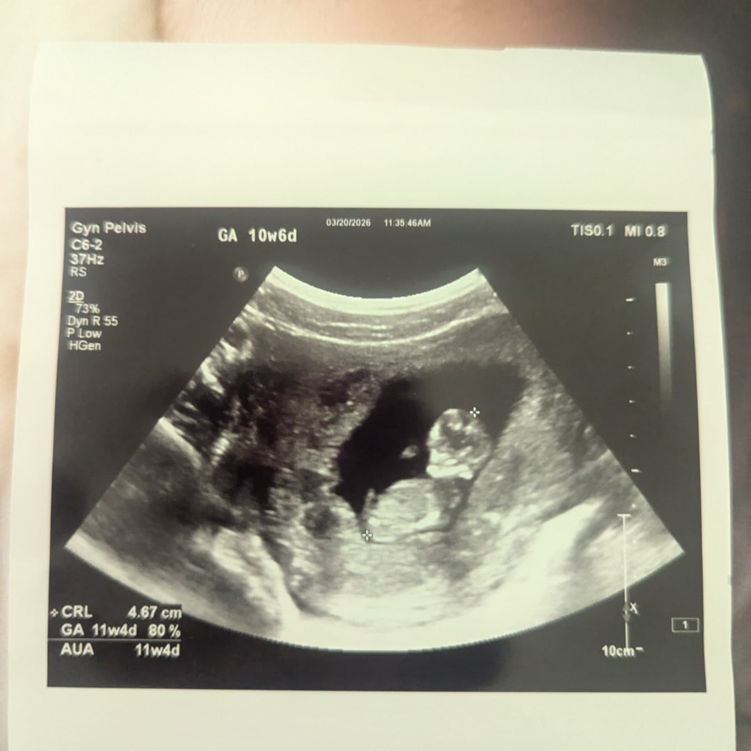 Photo shared by Kelsea for their Babylist baby registry.