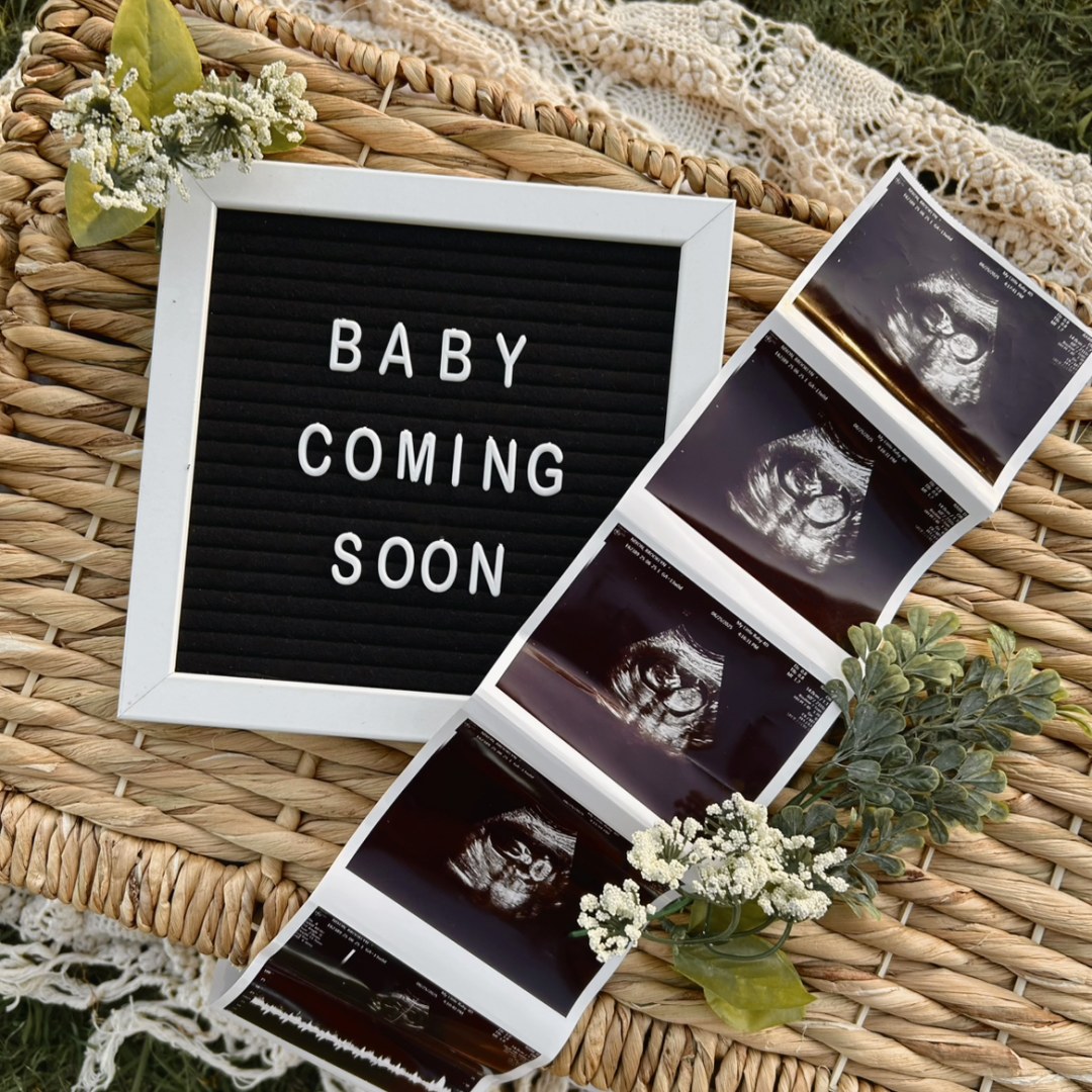 Photo shared by Brooklyn for their Babylist baby registry.