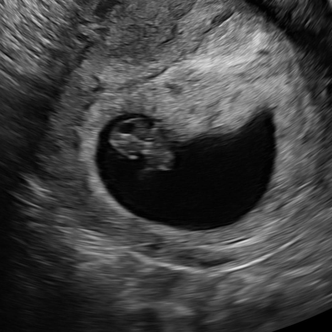 Photo shared by Monica for their Babylist baby registry.