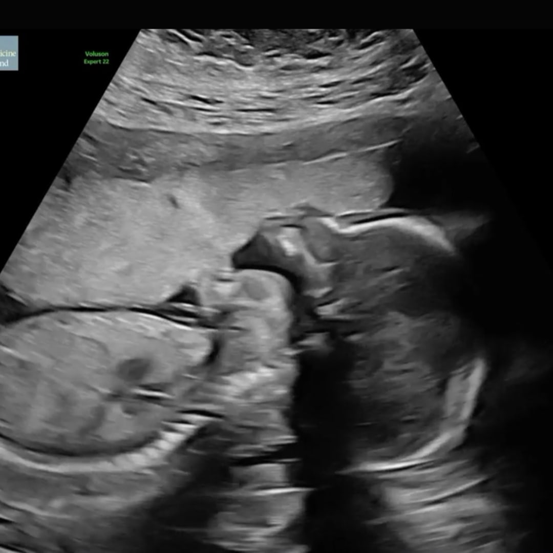 Photo shared by Kimberly for their Babylist baby registry.