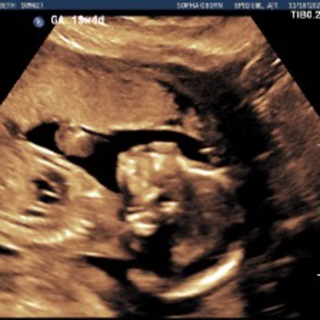 Photo shared by Elizabeth for their Babylist baby registry.