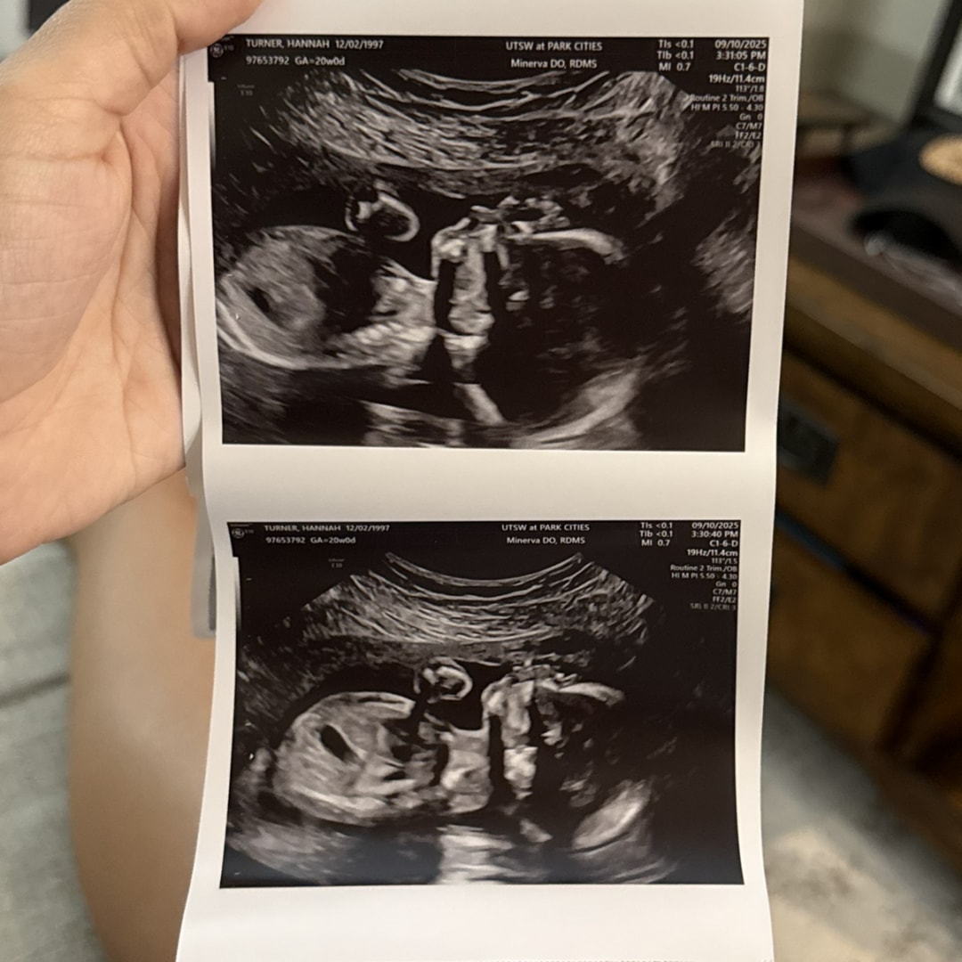 Photo shared by Hannah for their Babylist baby registry.