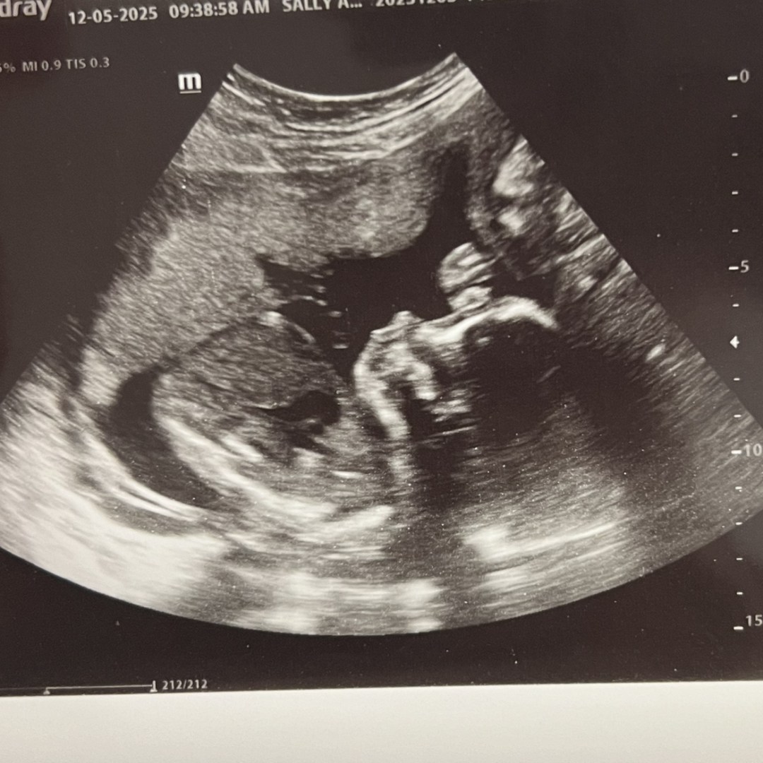 Photo shared by Kyra for their Babylist baby registry.