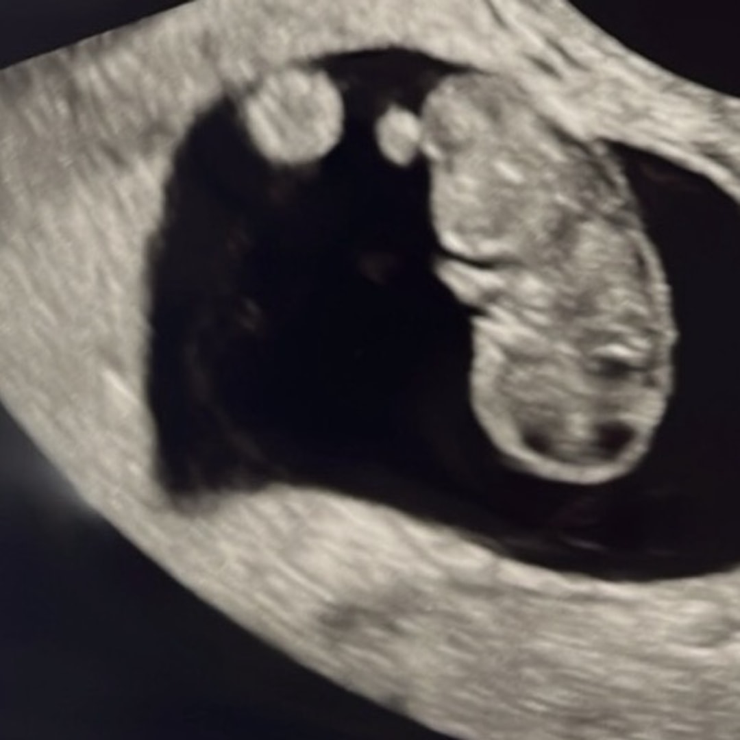 Photo shared by Aliya for their Babylist baby registry.