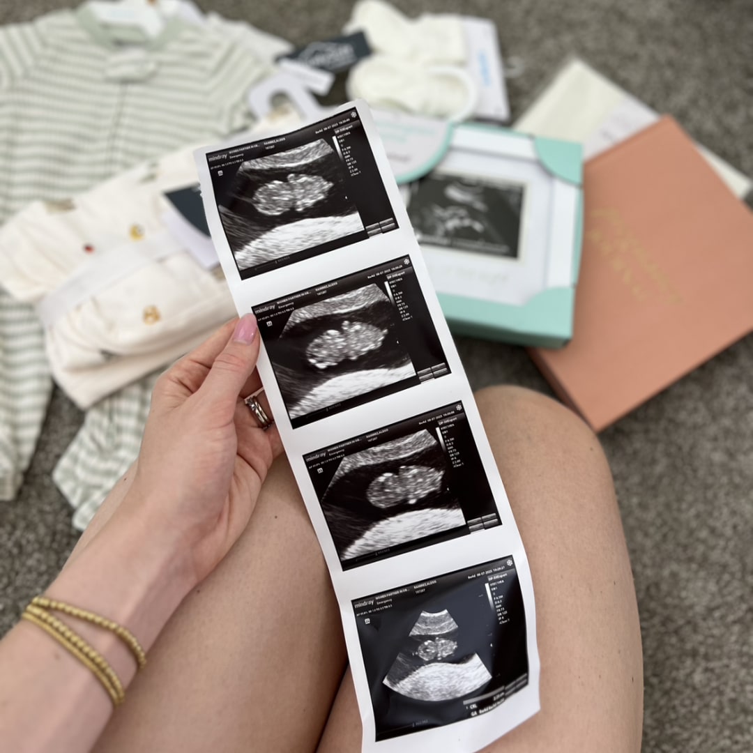 Photo shared by Lexi for their Babylist baby registry.