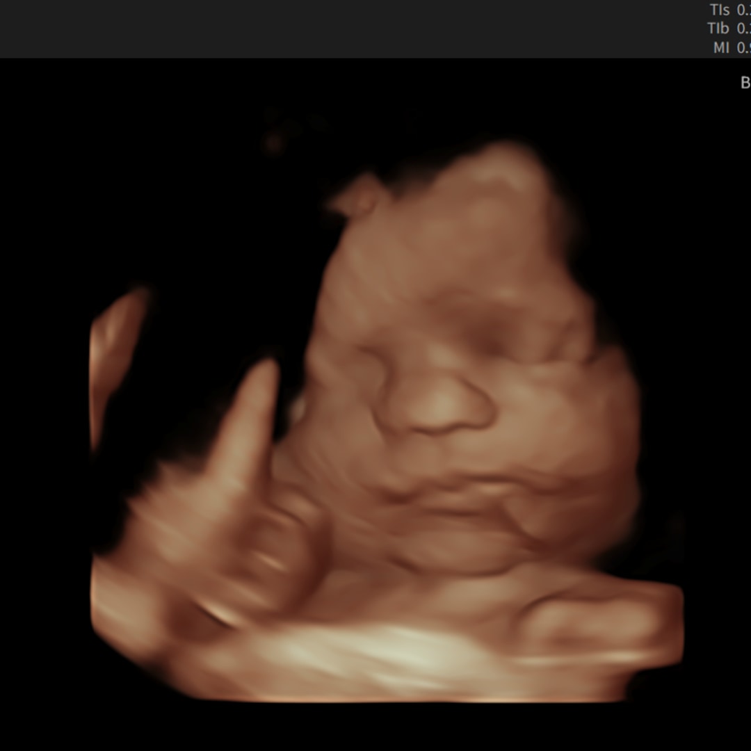 Photo shared by Vic for their Babylist baby registry.