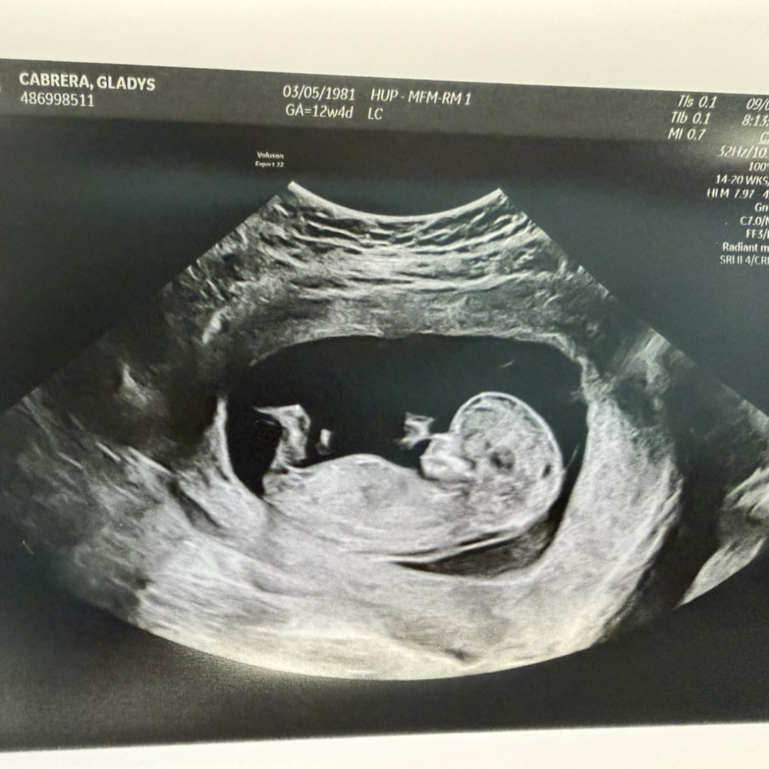 Photo shared by Gladys for their Babylist baby registry.