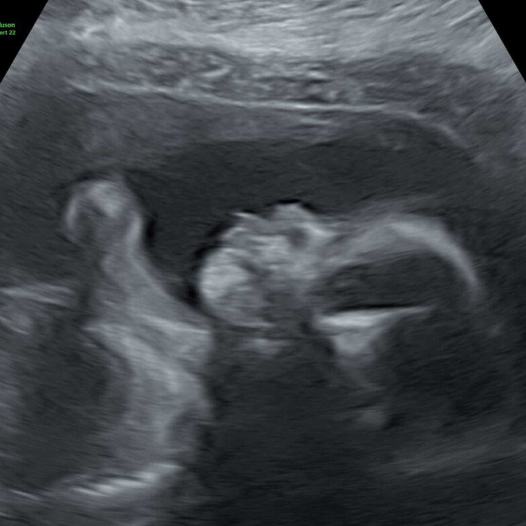 Photo shared by Denise for their Babylist baby registry.