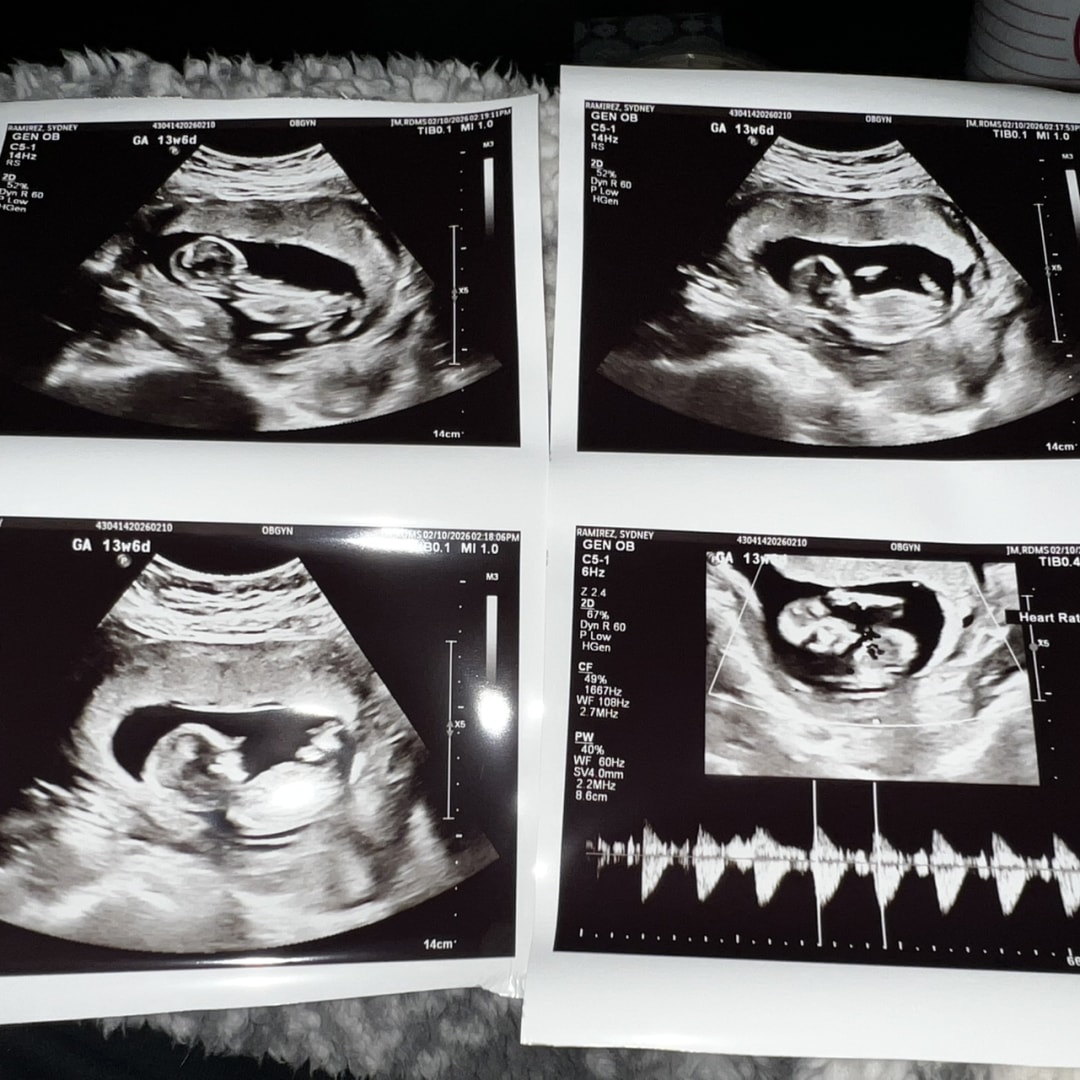 Photo shared by Sydney for their Babylist baby registry.