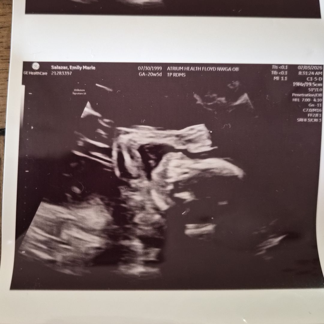 Photo shared by Emily for their Babylist baby registry.