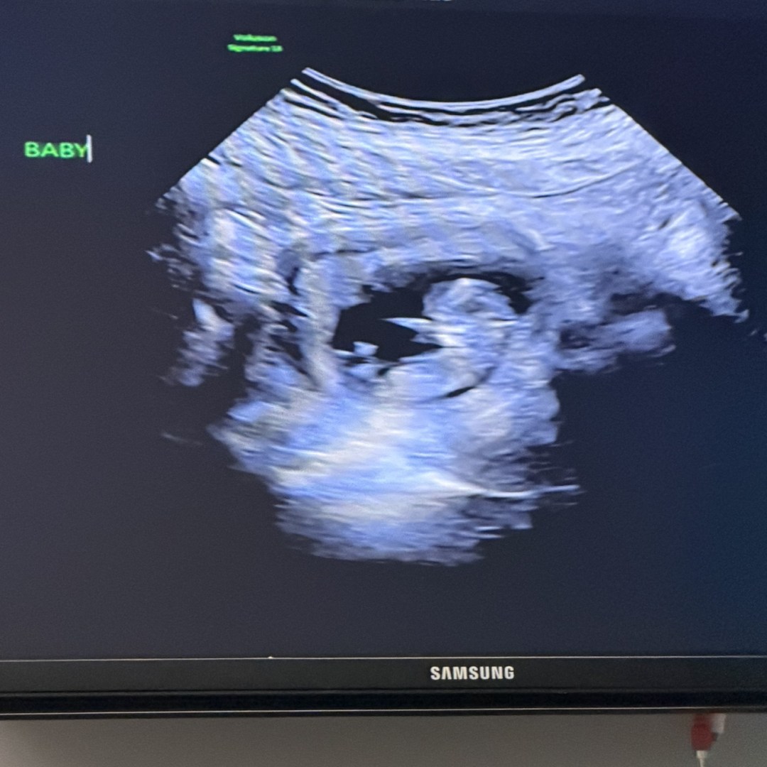 Photo shared by Jordan for their Babylist baby registry.