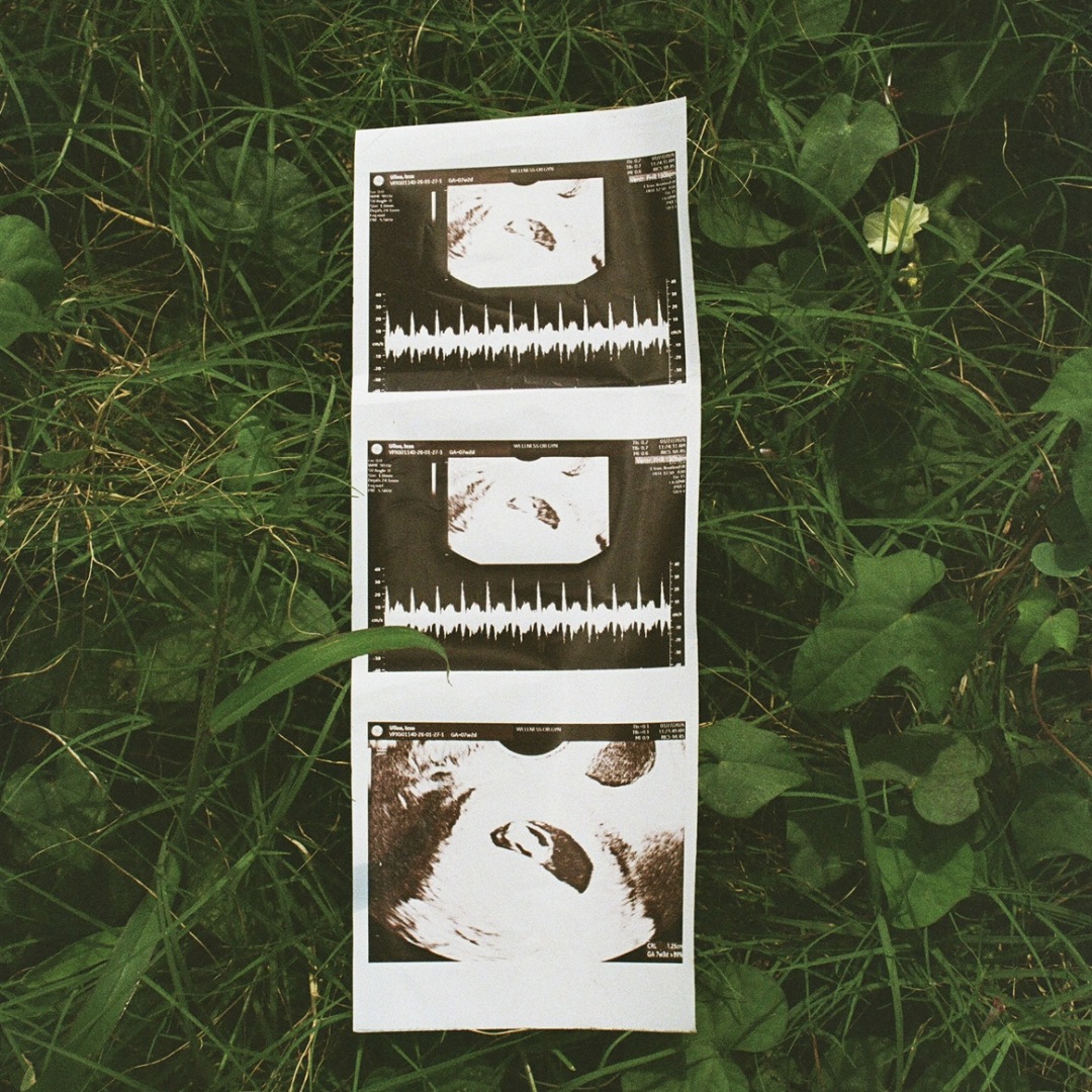 Photo shared by Anahizza for their Babylist baby registry.