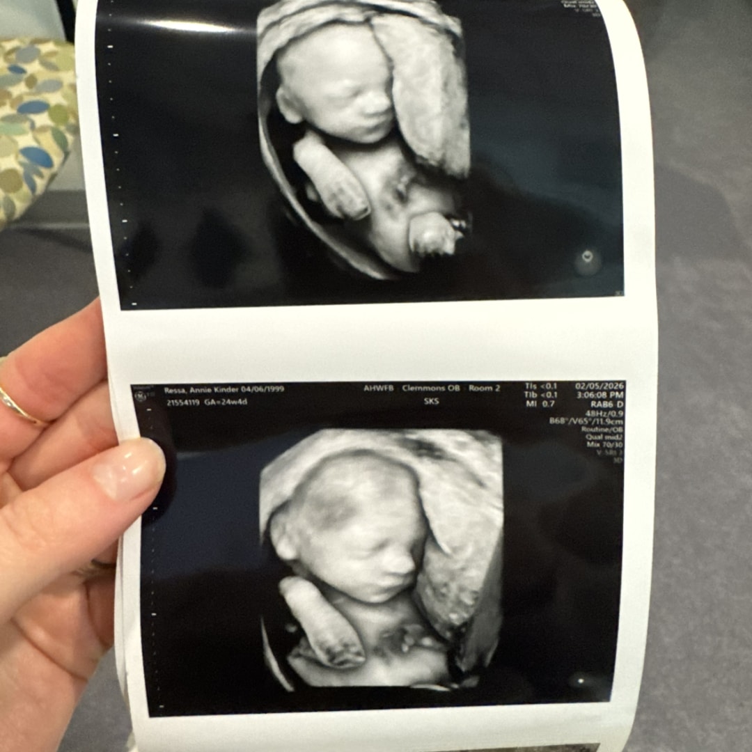 Photo shared by Annie for their Babylist baby registry.